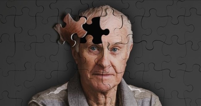 Alzheimer Tedavisi Nasıl Yapılır?